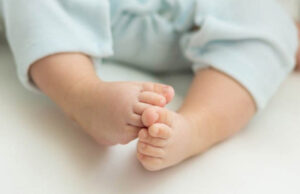 Doğuştan Çarpık Ayak Sendromu (Pes Ekonovarus) ve Tedavisi